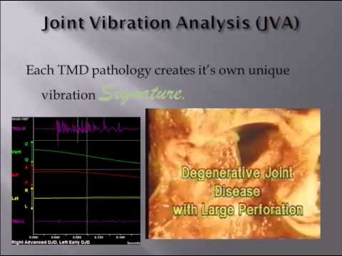 JVA Basic explanation